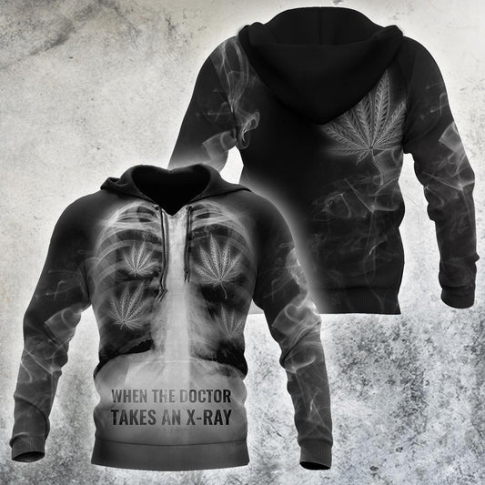 Collection Doctor X Ray Hippie Passion Art – 3D Hoodie